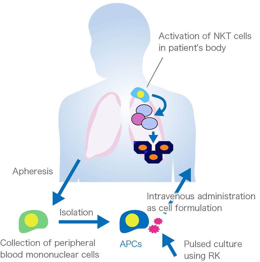 RK-X-pulsed autologous APC treatment process