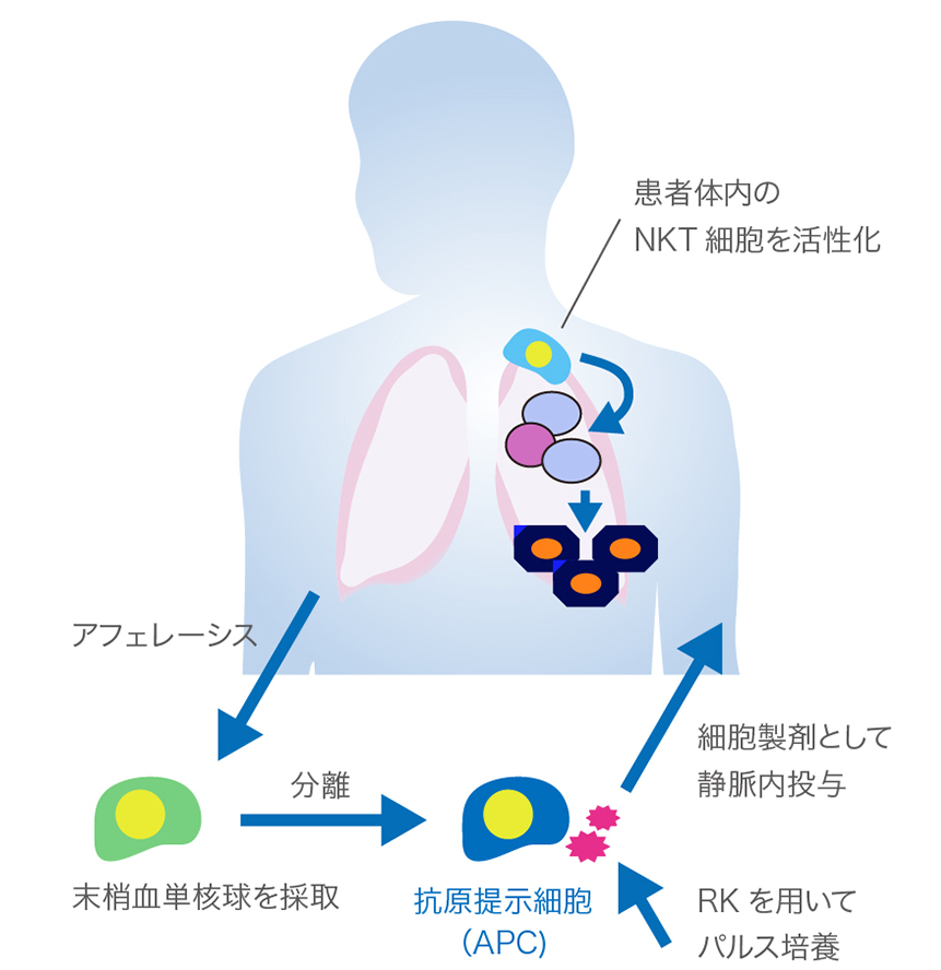 細胞加工製品の製造